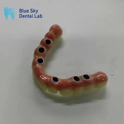 주문 비생식 증기 비생식 임플란트 케이스 보편적 호환성 online manufacture