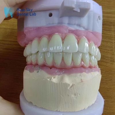주문 유니버설 호환성 순수한 티타늄 프레임으로 금속 마로 브리지 online manufacture