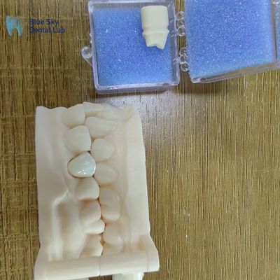 주문 미적 지르코니아 치아 복원 지르코니아 포르셀린 왕관 online manufacture