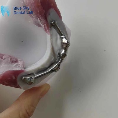 주문 치아 교제용 치아 치아 교제용 치아 교제용 치아 online manufacture