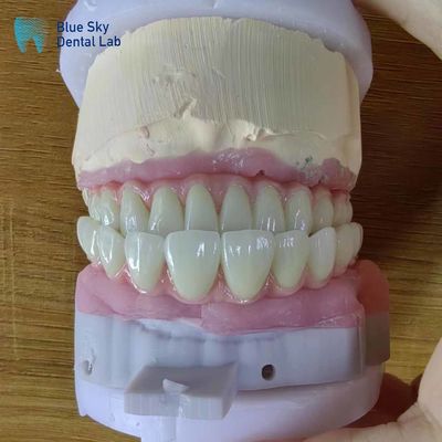 주문 인위적인 전체 아치 치아 임플란트 수술 절차에 대한 수술 케이스 online manufacture