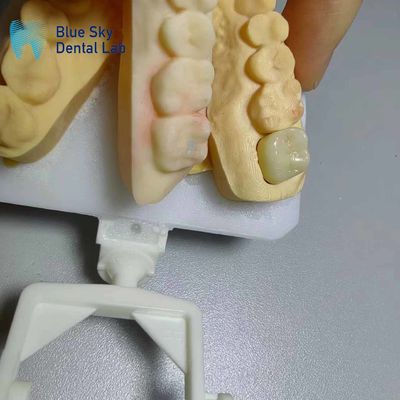 주문 부식 내성 지르코니아 왕관 자연스러운 모양 지르코니아 치아 online manufacture