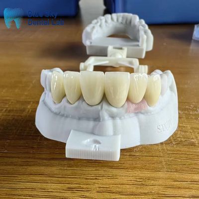 주문 매우 투명 한 지르코니아 장층 왕관 online manufacture