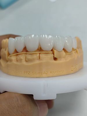 주문 5mm-6mm 계층 지르코니아 왕관 강도 지르코니아 다층 왕관 online manufacture