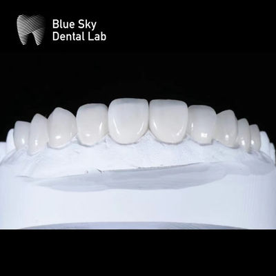 주문 슬리크 프리미엄 포니어 케이스 0.3mm 초 얇은 Emax 포니어 online manufacture
