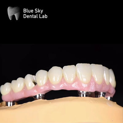 주문 블루 스카이 자연 치아 임플란트 케이스 다중 선택 임플란트 시스템 online manufacture