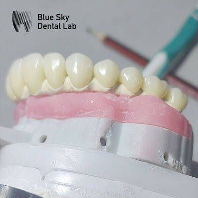 주문 순수한 티타늄 말로 임플란트 브리지 유니버설 금속 프레임 말로 브리지 online manufacture