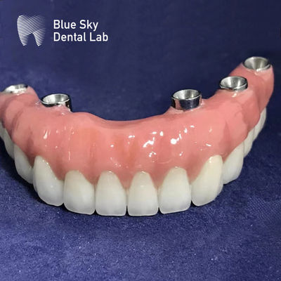 주문 보편적 자폐형 직사각형 임플란트 케이스 부드러운 표면 은색 online manufacture