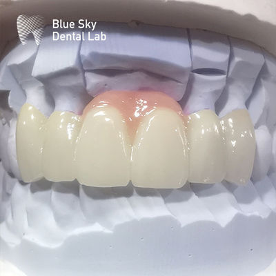 주문 장층 지르코니아 왕관 핑크 포르셀라인 미적 복원용 지르코니아 치아 왕관 online manufacture