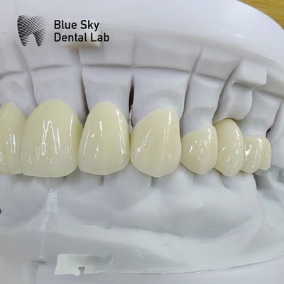 주문 투명층 지르코니아 왕관 치아 복원 다층 지르코니아 왕관 online manufacture