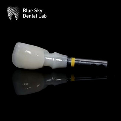 주문 티타늄 티바스 Zirconia Abutment 임플란트용 맞춤형 Zirconia Abutments online manufacture