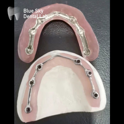 주문 치아 임플란트용 티타늄 막대 online manufacture