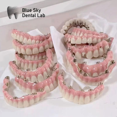 주문 블루 스카이 임플란트 케이스 마로 프레임 브리지 순수한 티타늄 online manufacture