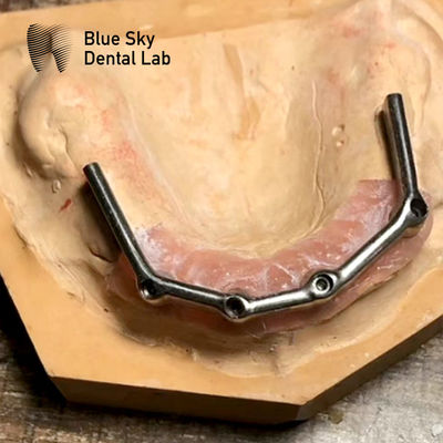주문 전체 상단 치아 티타늄 바 전체 입 복원 블루 스카이 임플란트 online manufacture