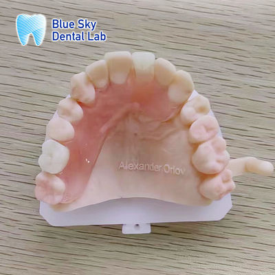 주문 자연스러운 외모의 제거 가능한 발플라스트 부분 치아 online manufacture