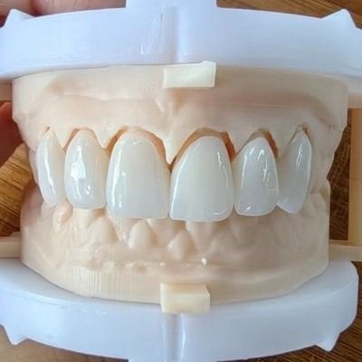 주문 자연적인 미용 장층 지르코니아 왕관 다리 아름다운 미소와 좋은 복원을 위해 online manufacture