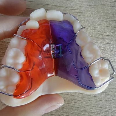 주문 맞춤형 솔루션을 위한 매끄러운 표면 플라스틱 임플란트 시나리오 online manufacture