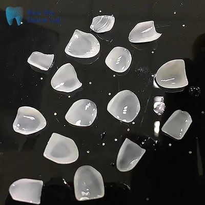 울트라틴 E 맥스 플라니어 인고트 클래스 세라믹 자연스러운 플라니어