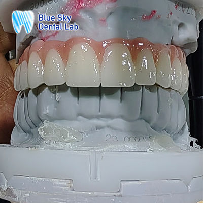 인공 치아 임플란트 케이스 다중 살균 임플란트 케이스