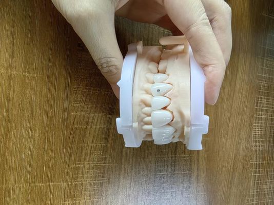 고도로 투명한 지르코니아 크라운 브리지 패니어 사용자 지정 보석과 금 아름다운 치아 복원 케이스