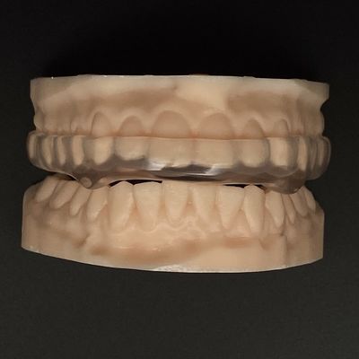 맑은 딱딱한 부드러운 정형 치아 야간 경비 수명 가속성 중량 보호 오클루설 스플린트 단단한 / 부드러운